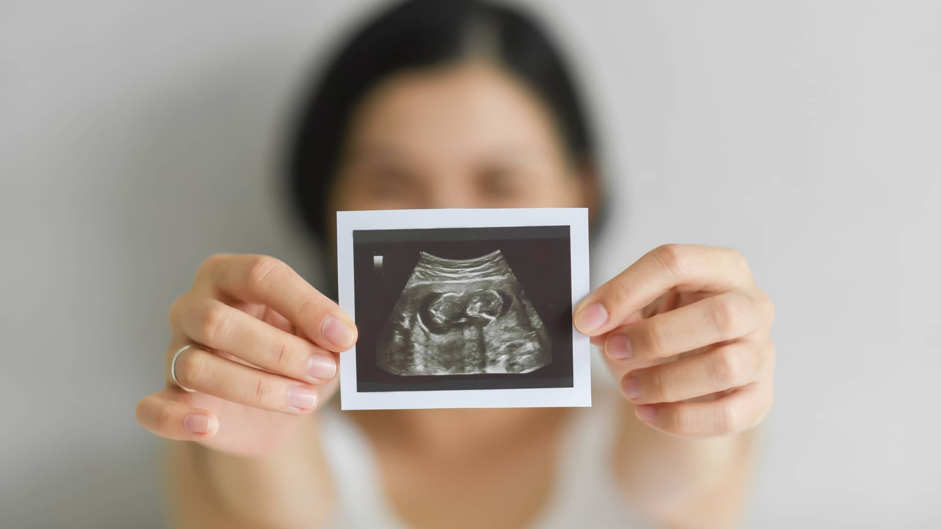 Las ecografías de embarazo te permiten ir conociendo a tu bebé