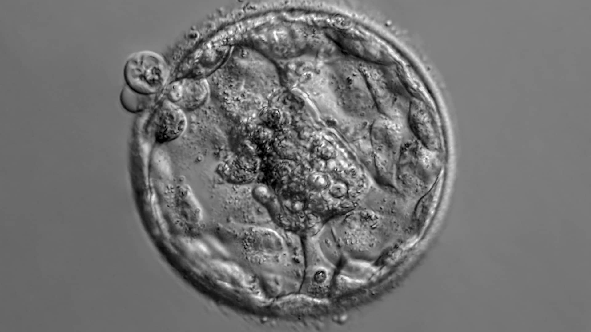 Fotomicrografía de un embrión humano aislado que representa la donación de embriones