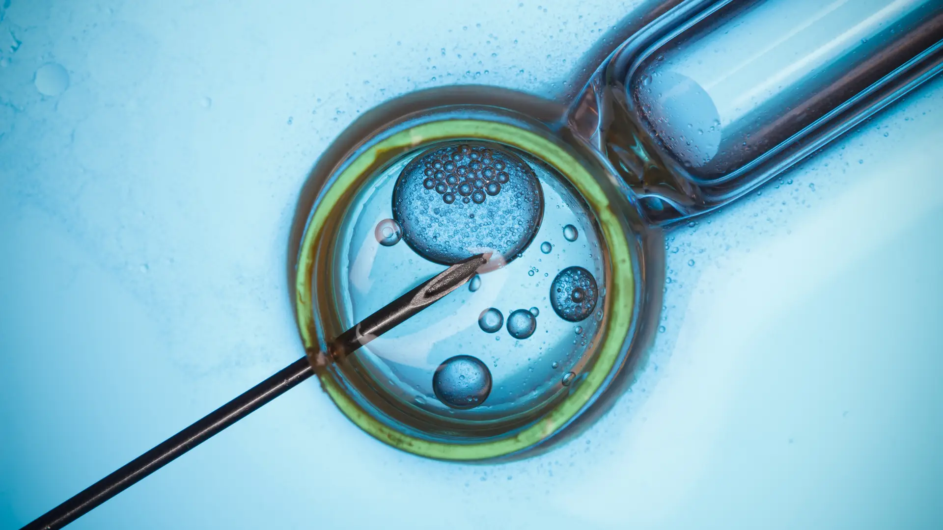 Diferencia entre fecundación in vitro e inseminación artificial: comparativa