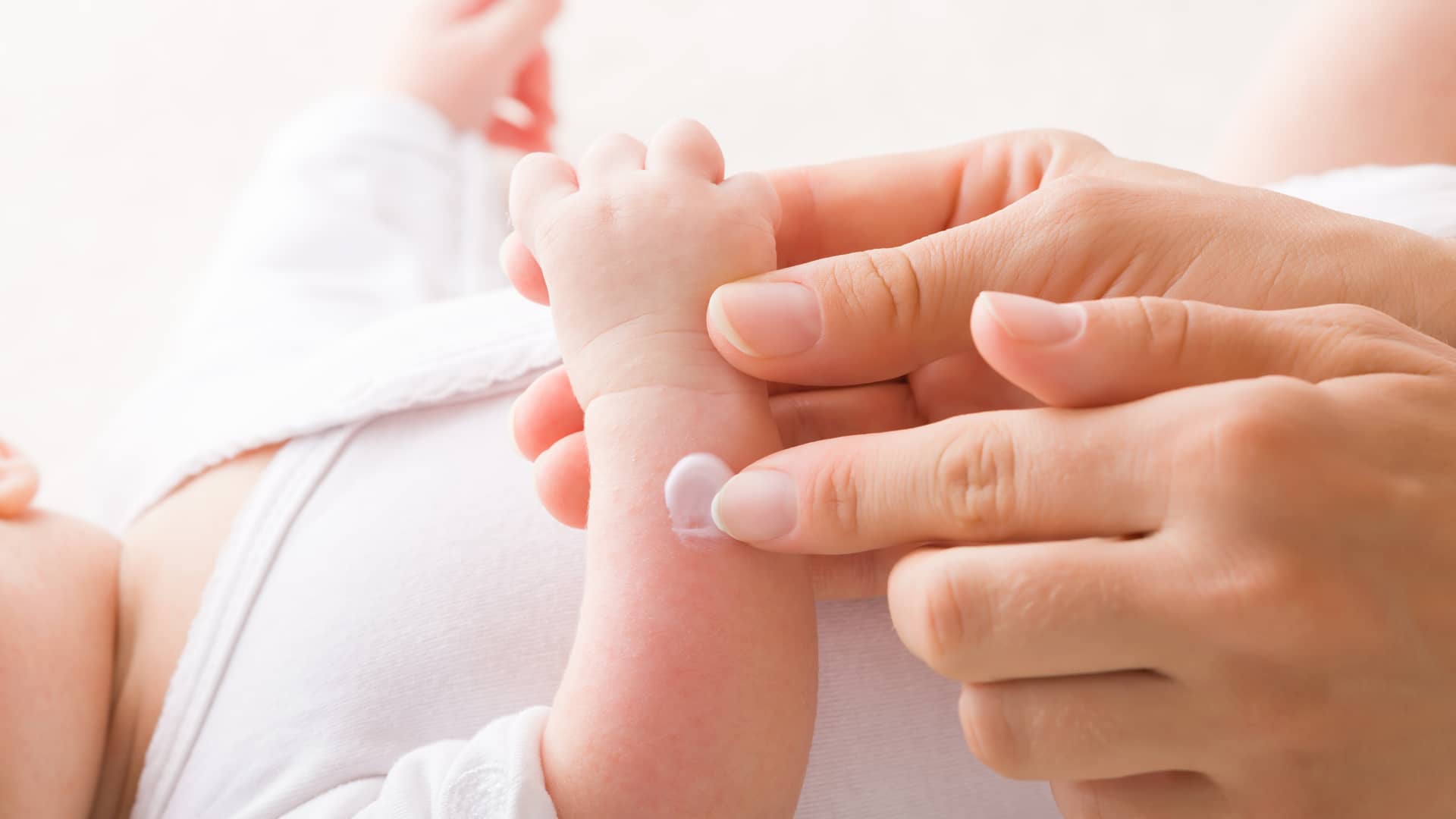 Dermatitis atópica del bebé: causas, síntomas, prevención y tratamiento