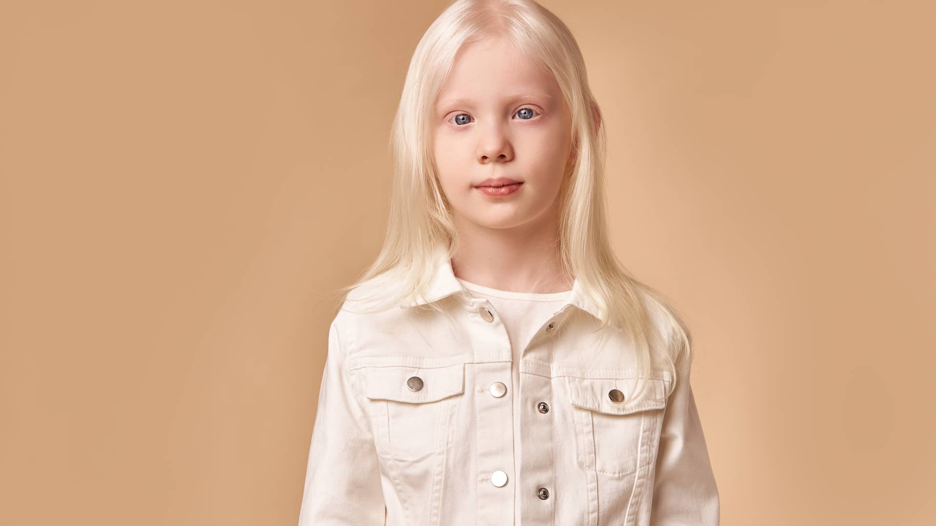 niña muy rubia y palida que sufre una de las enfermedades raras mas comunes llamada albinismo