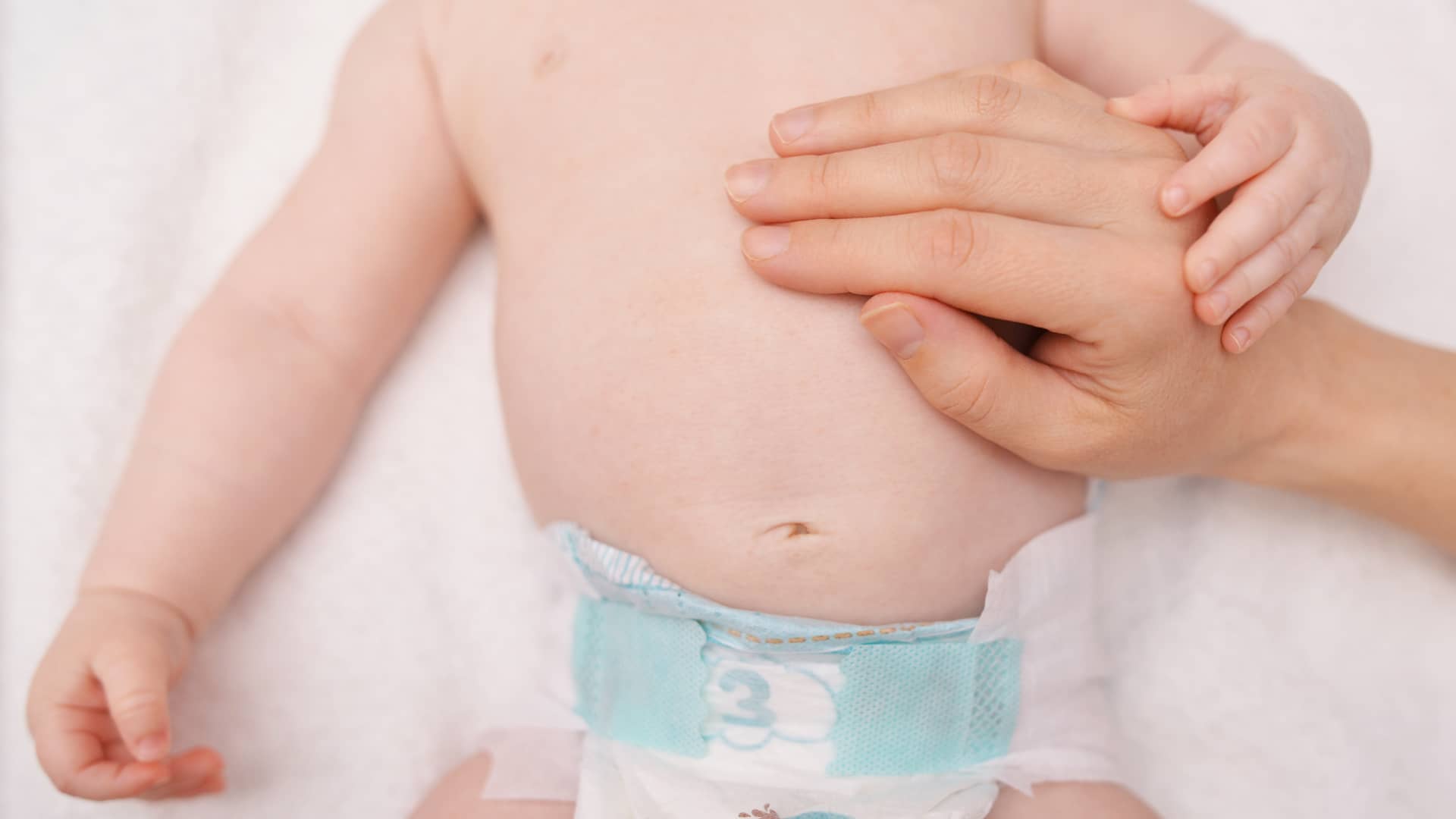 Hernia umbilical del bebé: ¿cómo se cura?