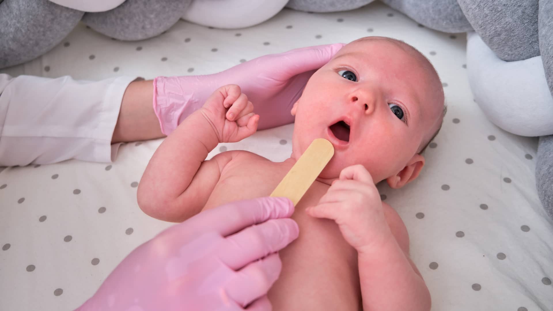 medico revisando la boca de un bebe para ver si sufre retrognatia